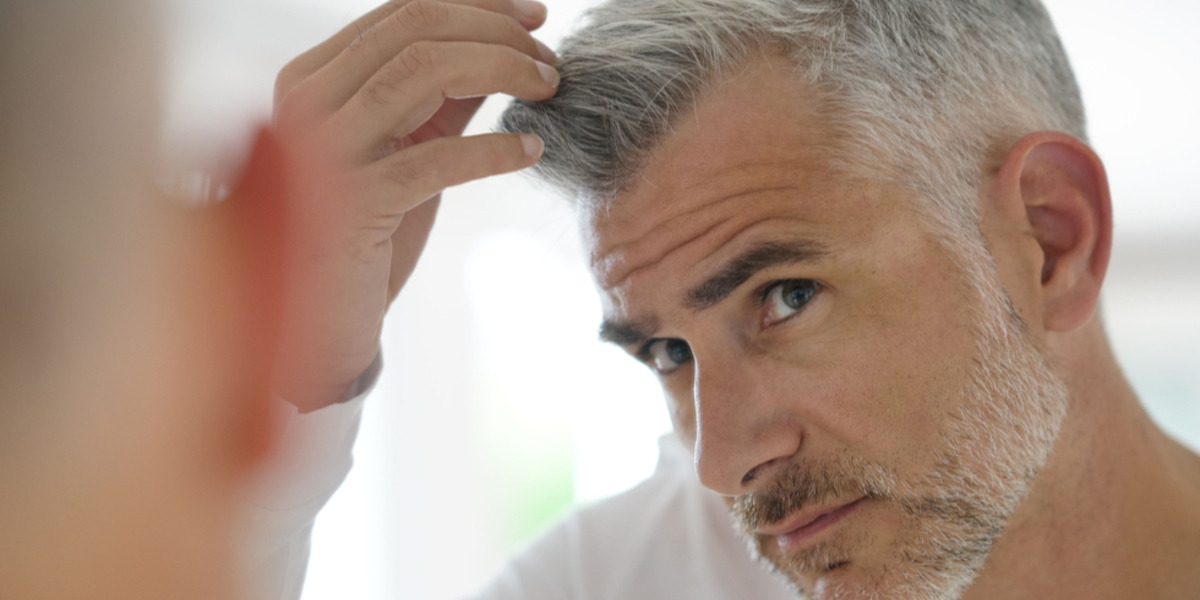 Waarom zijn mannen gevoeliger aan haarverlies dan vrouwen?