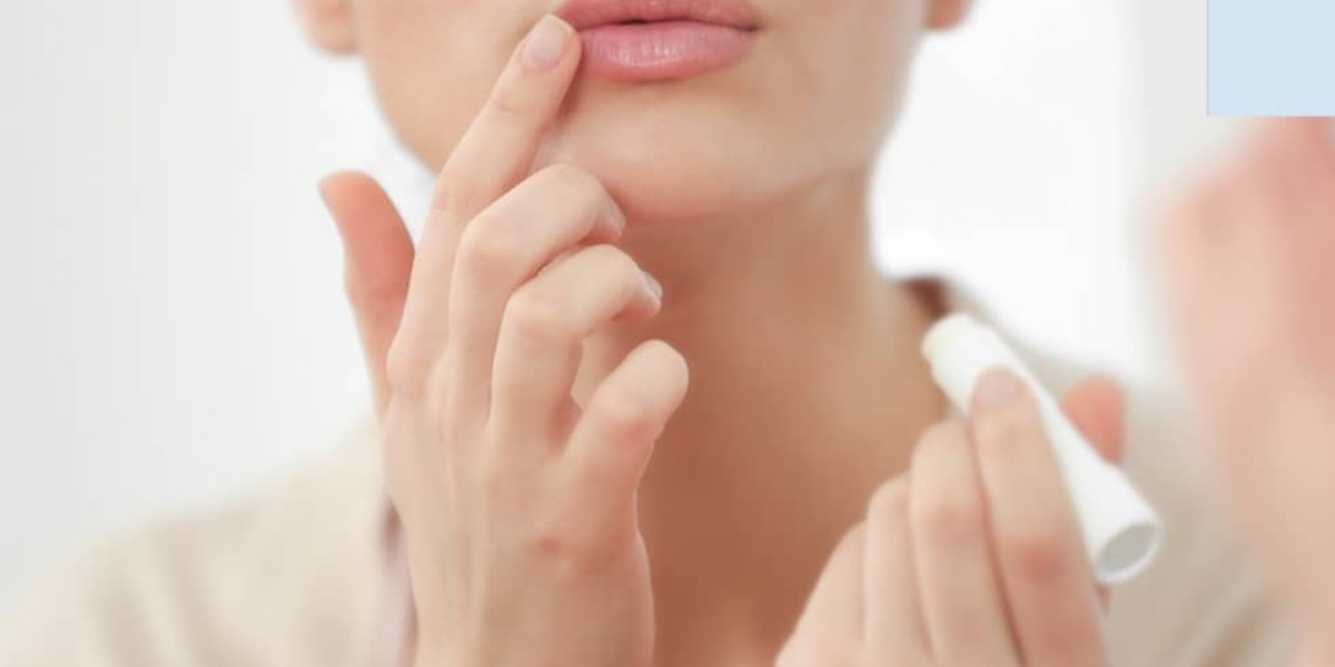 Hoe droge lippen en lipkloven voorkomen?